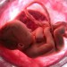 Conservación de la sangre del cordón umbilical