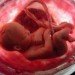 Casi la mitad de los padres han conservado las células madre del cordón umbilical del bebé al nacer Casi la mitad de los padres han conservado las células madre del cordón umbilical del bebé al nacer