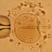 ICSI, una variación de la fecundación in vitro