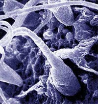 Imagen  aumentada de espermatozoide  