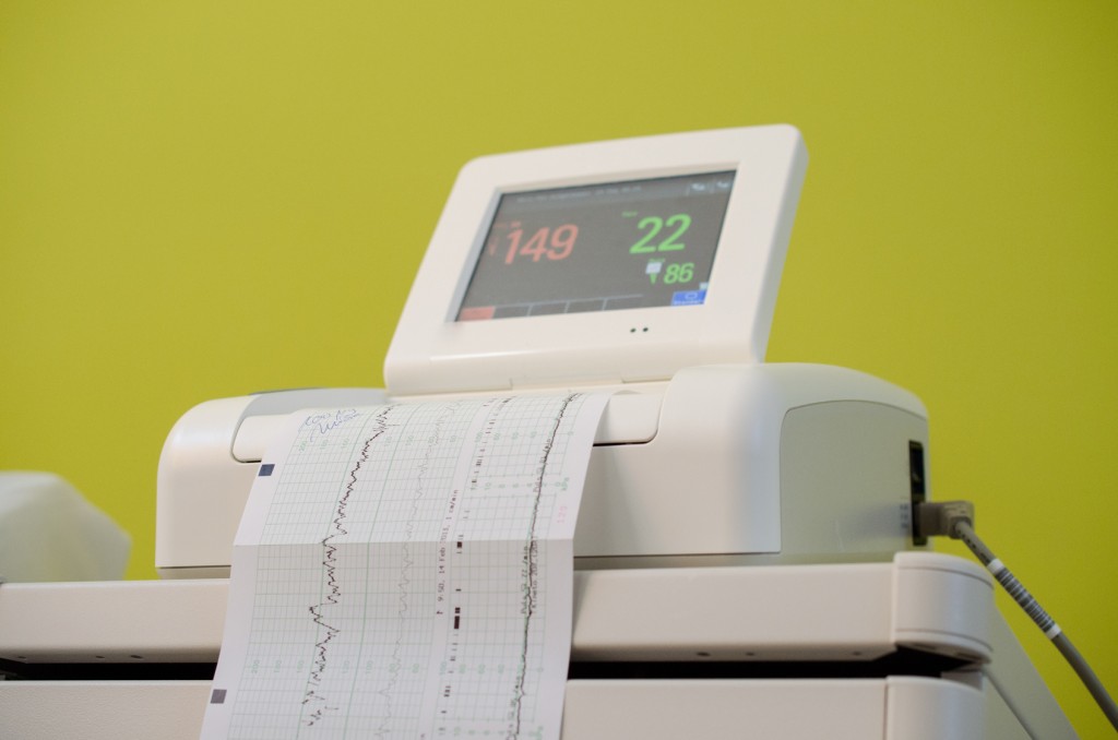 Monitorización fetal: qué es el cardiotocógrafo y para qué sirve | IMFER Blog