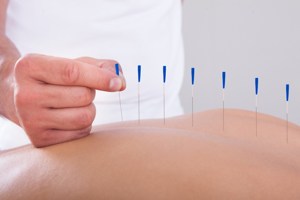 Acupuntura y fertilidad: qué dice la evidencia científica | IMFER Blog