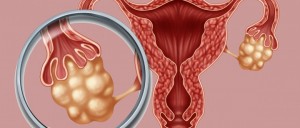 FIV con baja estimulación hormonal