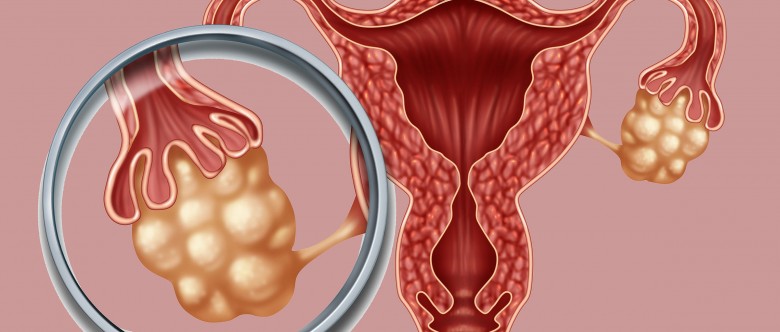 ciclo-ovarico-controlado-780x332