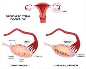 FSH biosimilar en fertilidad: eficacia, seguridad y ahorro