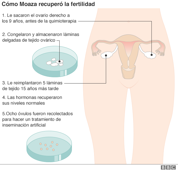 _92982805_graficoovarios
