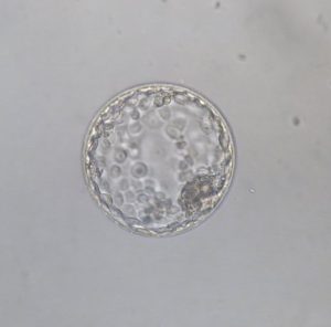Diagnóstico genético preimplantacional y enfermedades raras | IMFER Blog