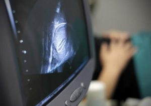 Reproducción asistida en el mundo: datos, cifras y avances actuales