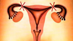 Embarazo tras ligadura de trompas con reproducción asistida | IMFER Blog