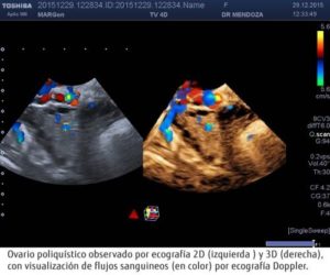 Nuevas técnicas en FIV: qué está cambiando en los laboratorios de embriología